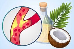 Tác động của sữa dừa đến mức cholesterol trong cơ thể