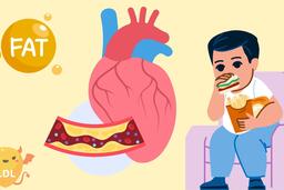 4 thói quen vô tình khiến cholesterol tăng cao