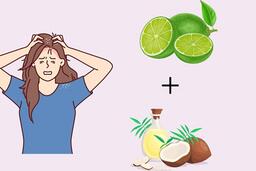 Đánh bay gàu chỉ với một bí quyết chăm sóc da đầu cực đơn giản