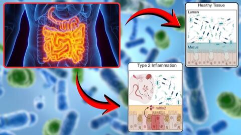 Phát hiện protein trong ruột có thể tiêu diệt vi khuẩn nguy hiểm