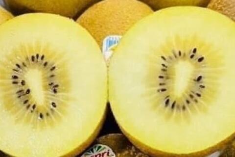 Lý do suy thận nên hạn chế ăn kiwi