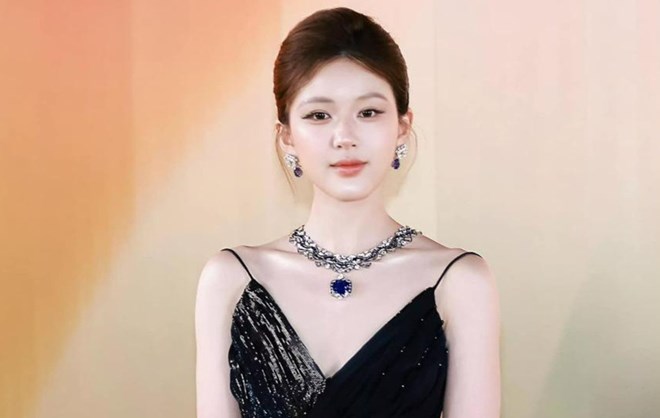 Triệu Lộ Tư liên tục vương nghi vấn phẫu thuật thẩm mỹ để trở nên đẹp hơn. Ảnh: Sohu