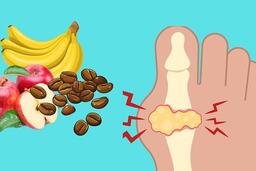 7 loại thực phẩm giúp giảm axit uric tự nhiên nếu mắc bệnh gút