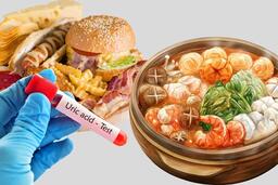 4 thực phẩm mà người axit uric cao nên tránh để phòng suy thận