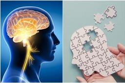 Thói quen tốt giúp trí não bộ khỏe mạnh, cải thiện trí nhớ