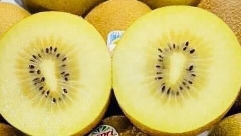 Lý do suy thận nên hạn chế ăn kiwi