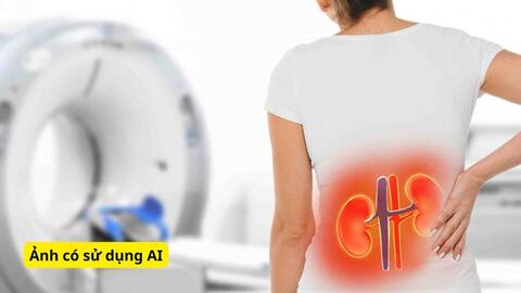 3 việc nên làm mỗi ngày giúp hạn chế tích tụ sỏi thận