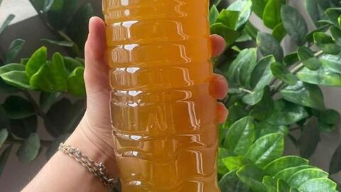 Lưu ý khi dùng mật ong với người tăng axit uric