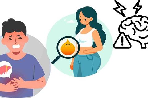 Gan quá tải, nguy cơ tích mỡ nội tạng vì một thói quen