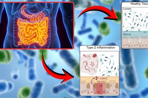 Phát hiện protein trong ruột có thể tiêu diệt vi khuẩn nguy hiểm