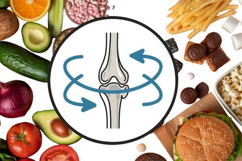 Xương khớp bị hủy hoại âm thầm bởi 4 loại thực phẩm