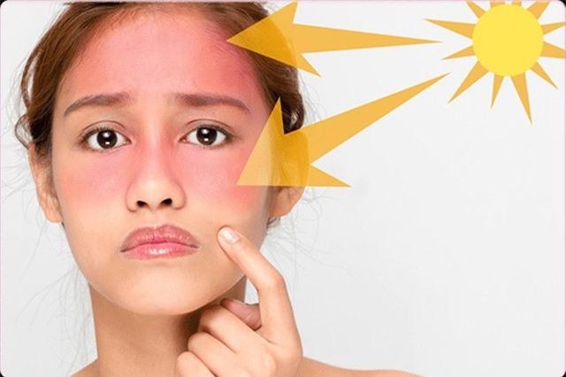 Nguyên nhân và cách điều trị tăng sắc tố da hiệu quả