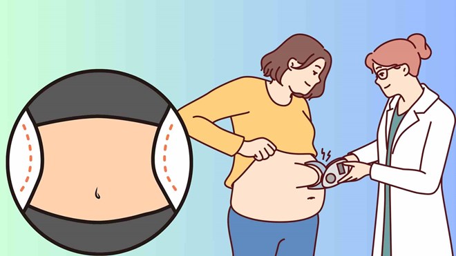 Mẹo giúp da bụng luôn mịn màng, săn chắc