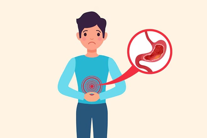 Giảm trào ngược axit với phương pháp nhịn ăn gián đoạn