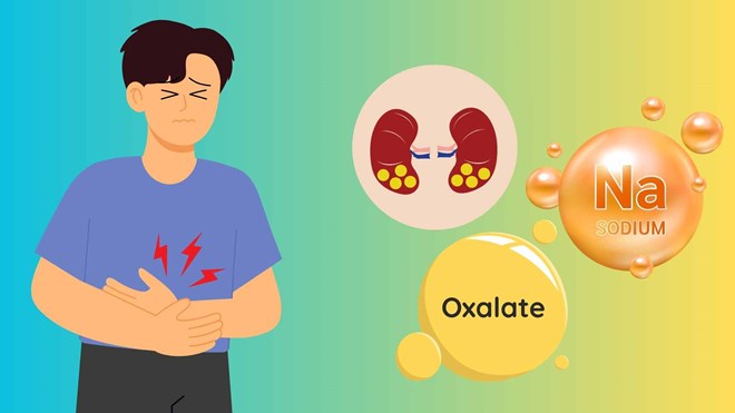 3 thói quen giúp ngăn ngừa sỏi thận
