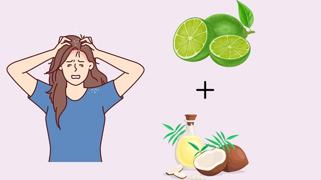 Đánh bay gàu chỉ với một bí quyết chăm sóc da đầu cực đơn giản
