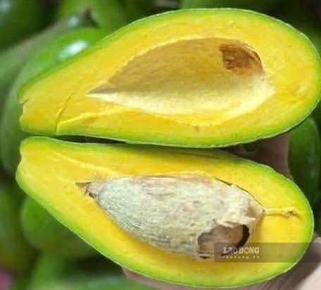 Những thực phẩm có thể bổ sung magie nếu không thích ăn chuối