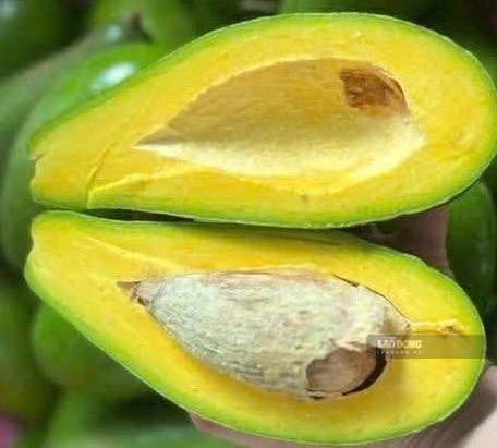 Hỗ trợ ổn định đường huyết bằng cách ăn trái bơ vào buổi tối